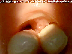 IUX239-QWWSCEJRSQ466655488